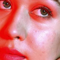 What to use on an irritated skin?